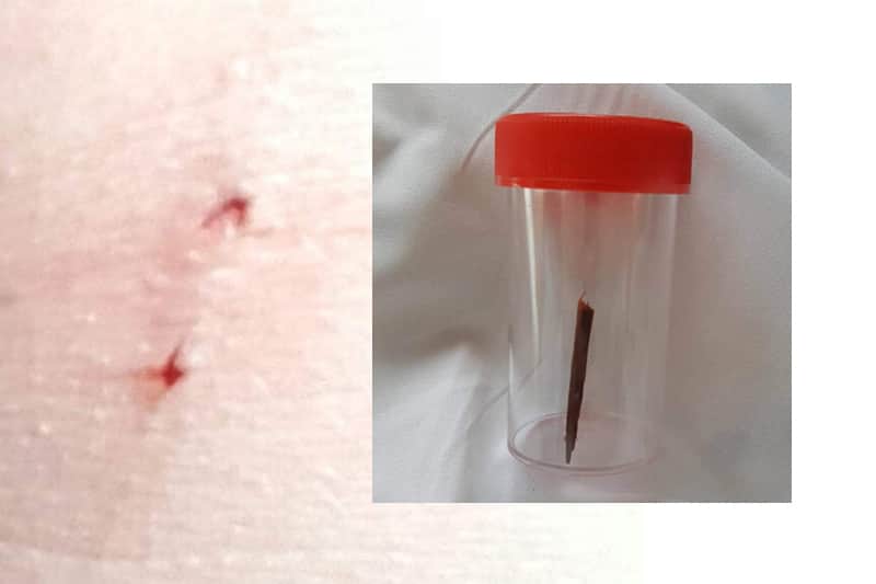 blessure-bois-fesse