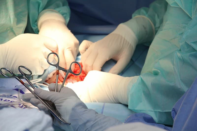 operation