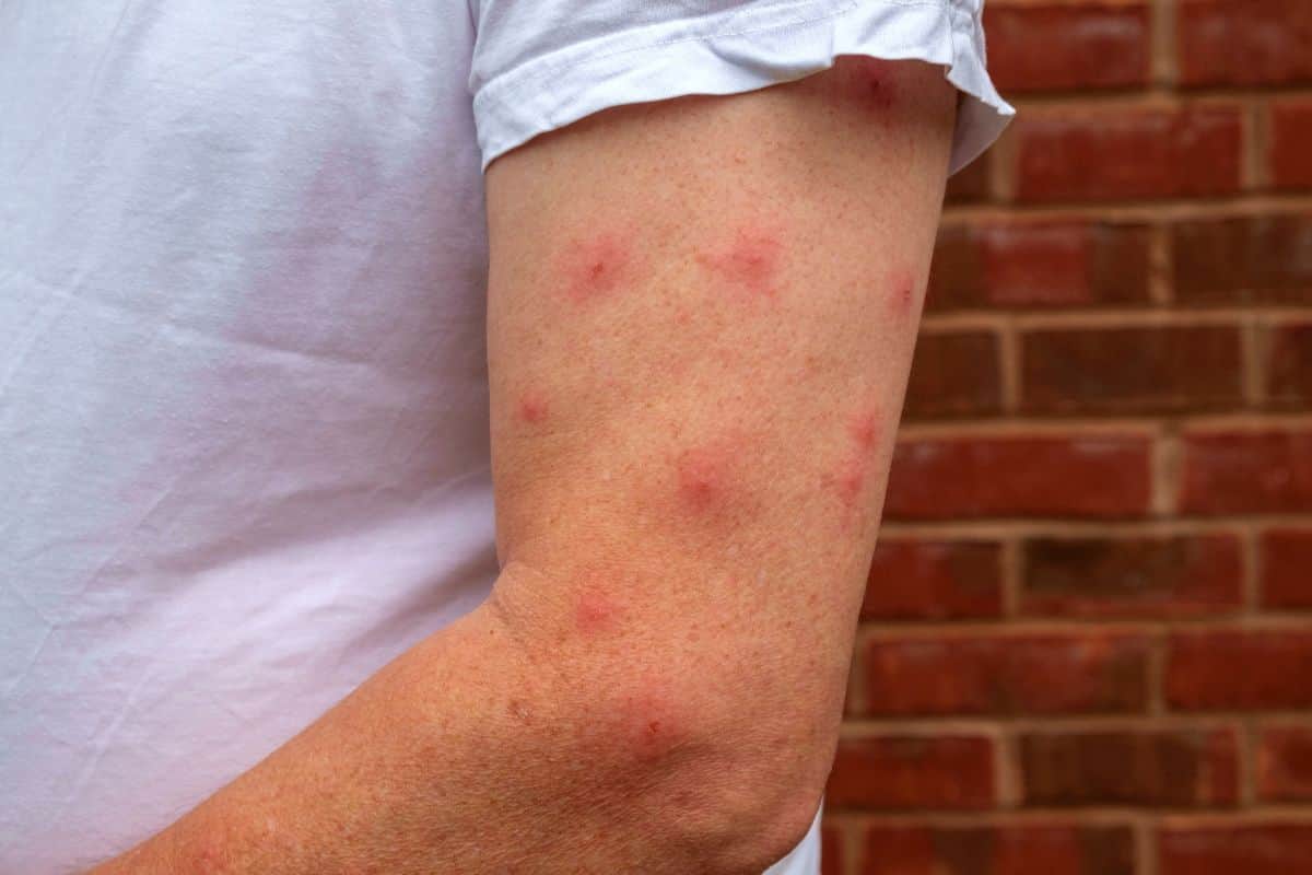 Deux décès confirmés liés au chikungunya à La Réunion