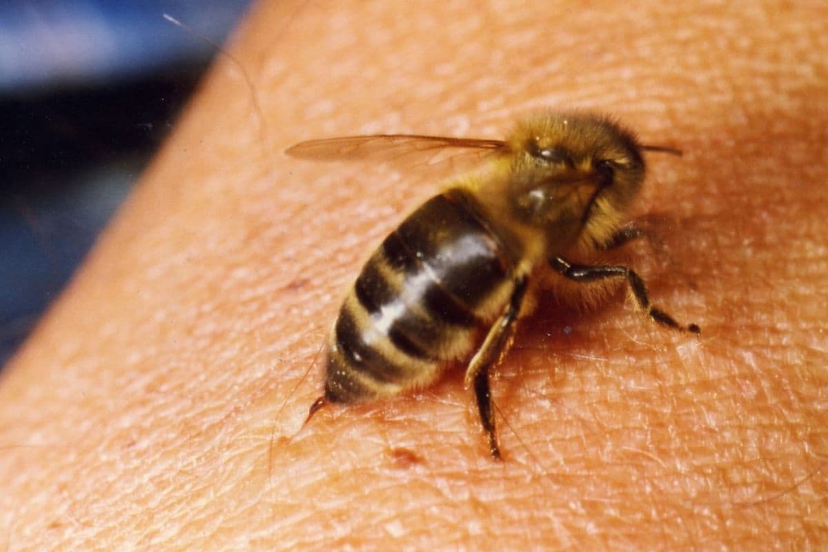 _Un espoir inattendu venu de la nature en Australie, le venin d’abeille a détruit un cancer du sein agressif en une heure seulement.