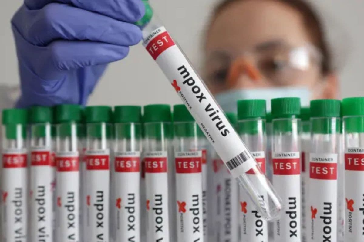 Mpox à La Réunion deux nouveaux cas confirmés, les autorités sanitaires renforcent la surveillance