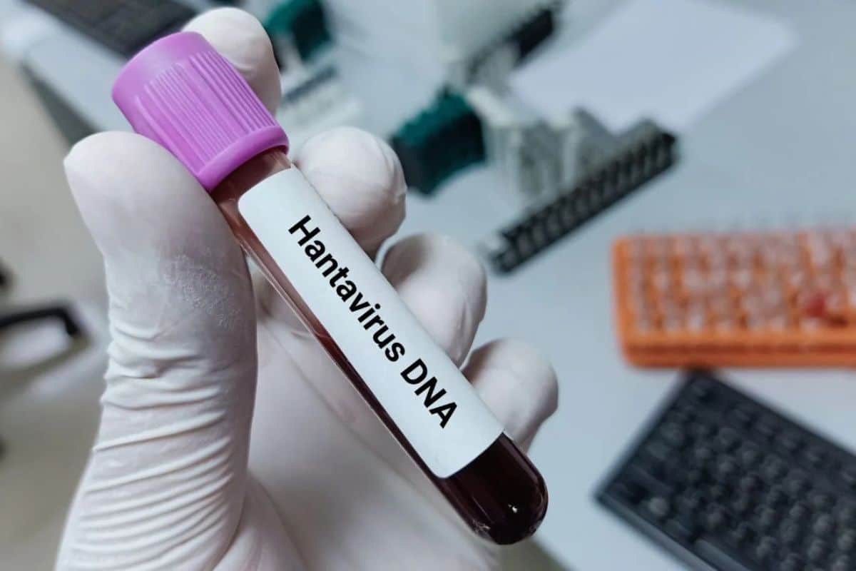 Hantavirus faut-il craindre un nouveau confinement en France Ce que disent vraiment les experts
